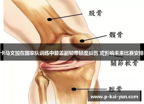 卡马文加在国家队训练中膝盖副韧带轻度扭伤 或影响未来比赛安排 卡马文加在国家队训练中膝盖副韧带轻度扭伤 或影响未来比赛安排